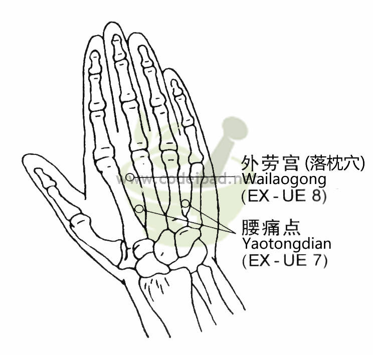 腰痛点