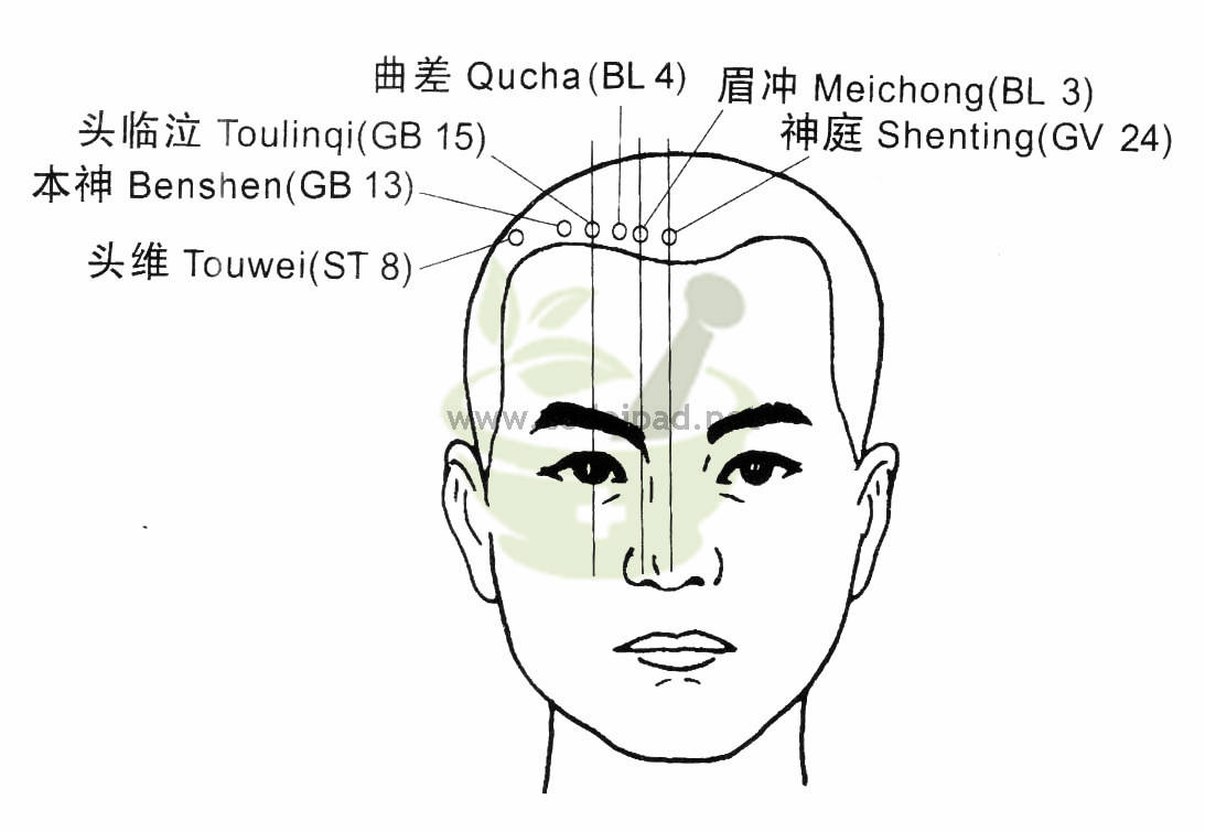 头临泣